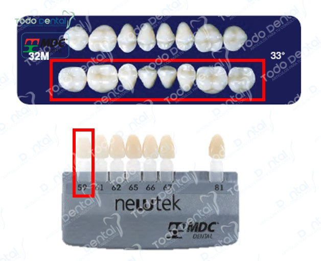 Diente new tek posterior inferior