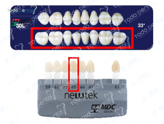 Diente new tek posterior inferior