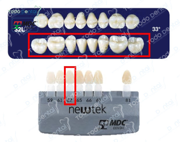 Diente new tek posterior inferior