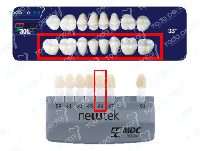 Diente new tek posterior inferior