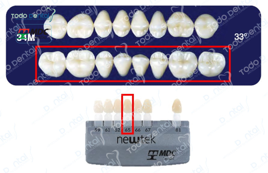 Diente new tek posterior inferior